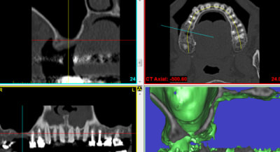 Ro3 p8behx - Eugenol