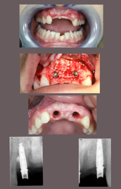 Rog copie o9gj4x - Eugenol