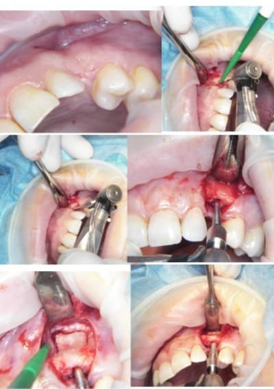 Rog ku8y9a - Eugenol