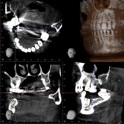 Rot 2 qhysvq - Eugenol