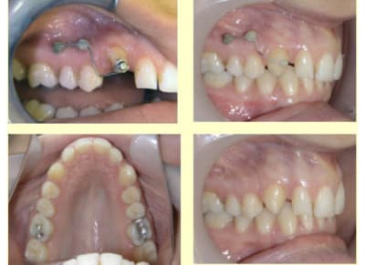 Rotation canine r4nqzo - Eugenol