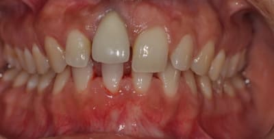 Rp3glfiqvbwvddqj5jix - Eugenol