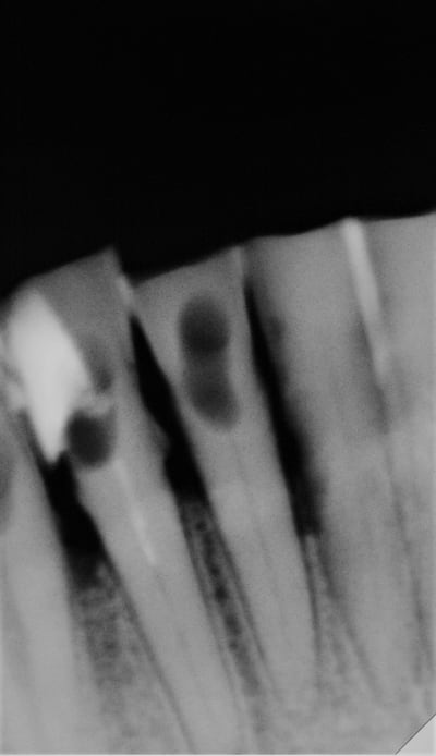 Rvgdf aonh73 - Eugenol