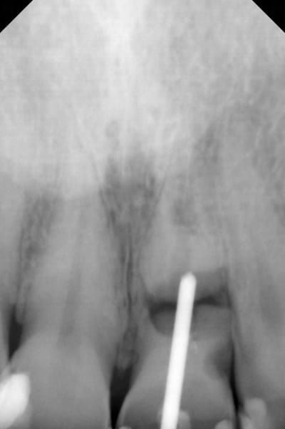 Rvkd6fcvdukqorxwefwu - Eugenol