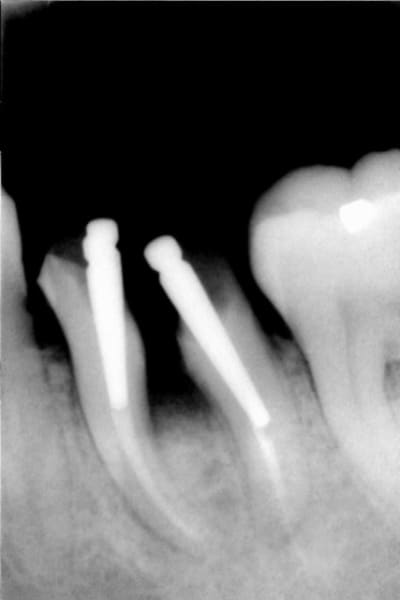 Séparation rlaltm - Eugenol