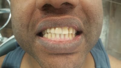 S2trwzyzozdfbapzktbb - Eugenol