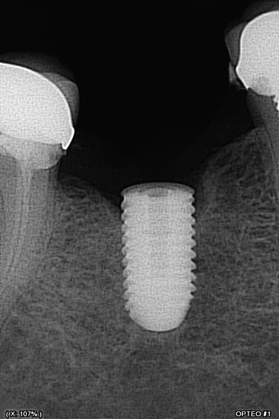 S874c6l04vmn6kjnewd2rhtwt2mb - Eugenol