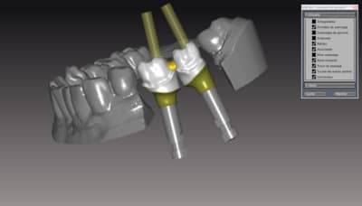 Sans gencive eg5noe - Eugenol