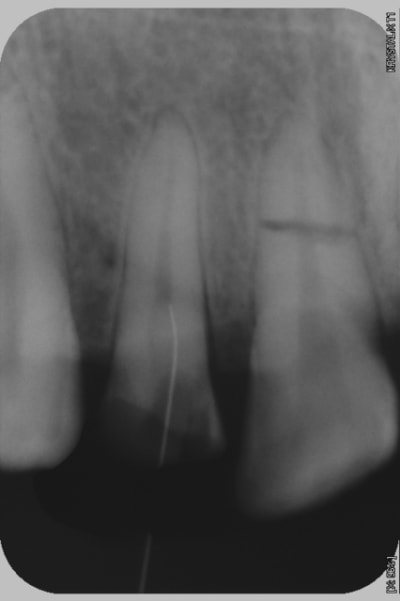 Saou vgobws - Eugenol