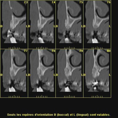 Scan 002 gc8tzs - Eugenol
