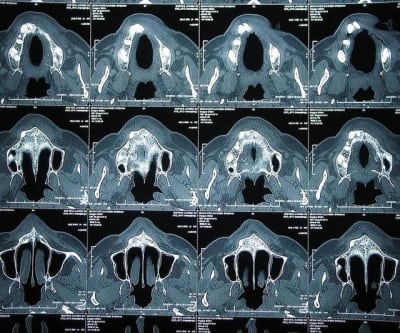 Scan2 buovfo - Eugenol