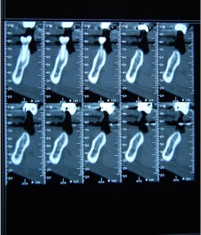 Scan2 zeouv8 - Eugenol