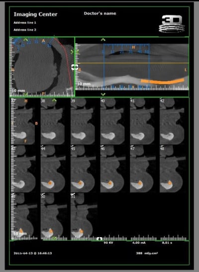 Scan 3 r3vc4s - Eugenol