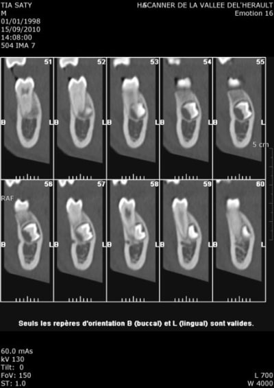 Scan 45 bis whtto4 - Eugenol