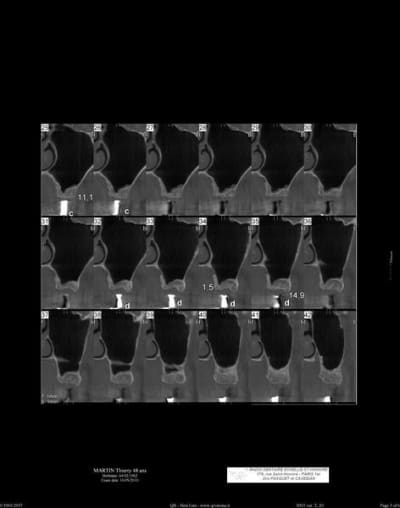 Scan gauche 2  800x600  kdd1id - Eugenol