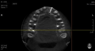 Scan greffe2 meswpp - Eugenol