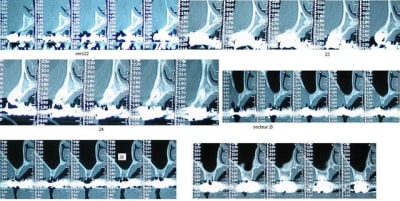 Scan haut gauche ioaz5j - Eugenol