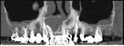Scan pano 1 b1pmiw - Eugenol