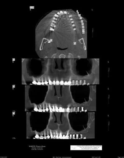Scan pano  800x600  md08ul - Eugenol