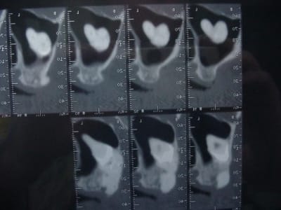 Scanner 002 jmrri6 - Eugenol