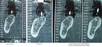 Scanner lvox2w - Eugenol