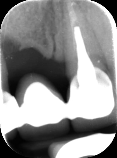 Sed2 hefqfd - Eugenol