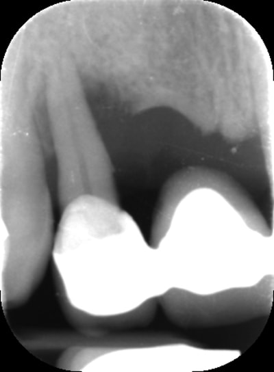 Sed adfzj9 - Eugenol