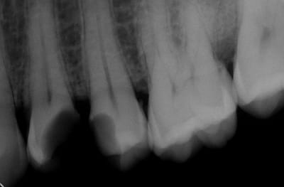 Sedd 1 nrugyk - Eugenol