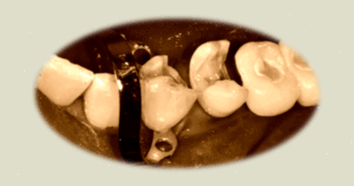 Sepia1 vm0pqj - Eugenol
