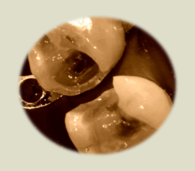 Sepia2 bqimlf - Eugenol