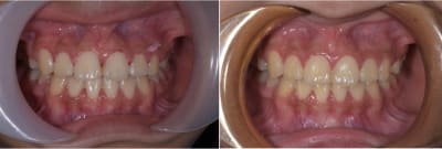 Sieng m1fc3v - Eugenol