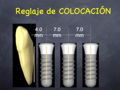 Slide - Eugenol