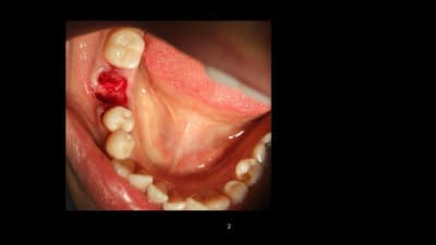 Slide 002 ozqrf4 - Eugenol