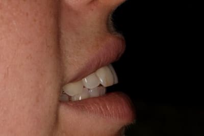 Smile3 mojhf4 - Eugenol