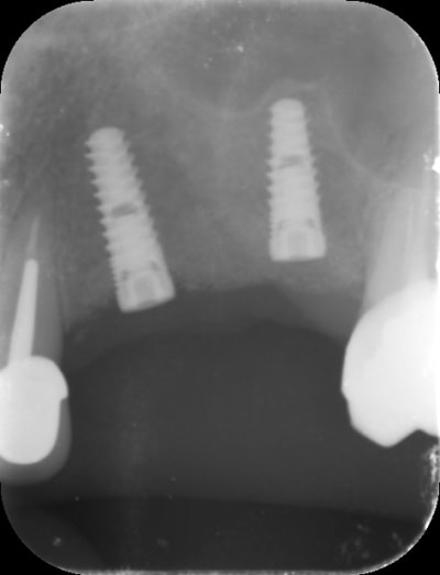 Songy2 usb22t - Eugenol