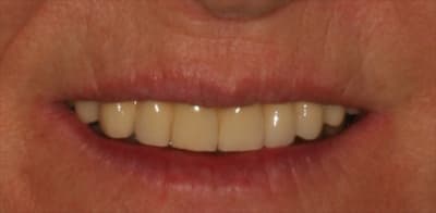 Sourire edvt4z - Eugenol