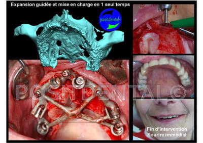 Sourire imm diat cv9ymo - Eugenol