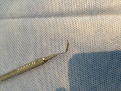 Spatule s4g3e2 - Eugenol