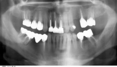 Spirou et cie iswuil - Eugenol