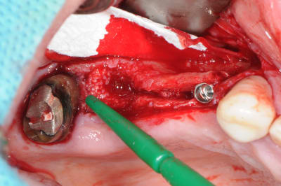 Sssimuhhtsgbfbjracn4 - Eugenol