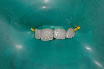 Strat fkynam - Eugenol