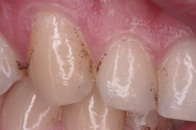 Taches  2   800x600  xbmufl - Eugenol