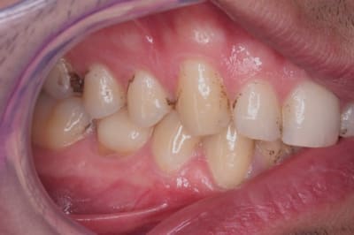 Taches  800x600  vrix10 - Eugenol