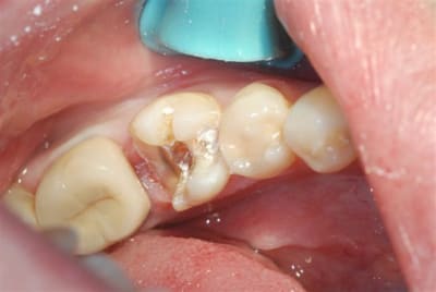 Taille t03lj2 - Eugenol