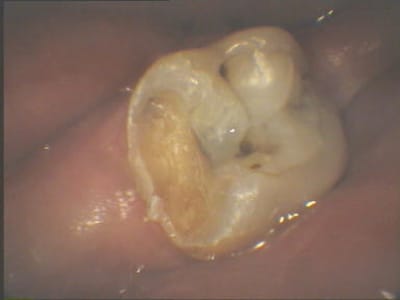 Tarc2 pnbu74 - Eugenol