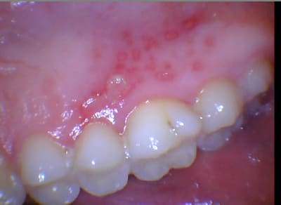 Te6pif27bkegzxsadouo - Eugenol