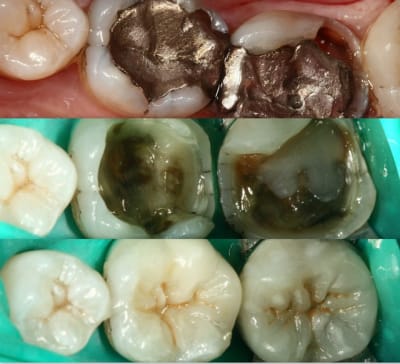 Technique f5k4aj - Eugenol