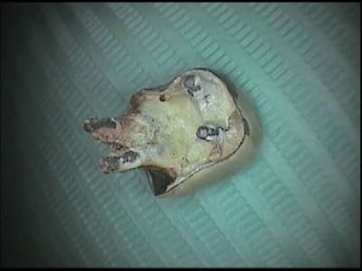 Tenons drwkdm - Eugenol