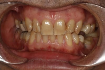 Test 2 ndzlxf - Eugenol