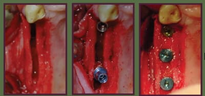 Test rua9v7 - Eugenol